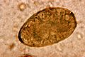 Paragonimus westermani 01